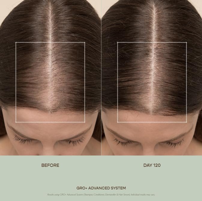 VEGAMOUR GRO+ Advanced Hair Serum for Hair Density, Reduces Shedding and Promotes a Healthy Scalp, Helps with Severe Signs of Thinning, Made Without Fragrance, Vegan, Cruelty-Free - Image 5
