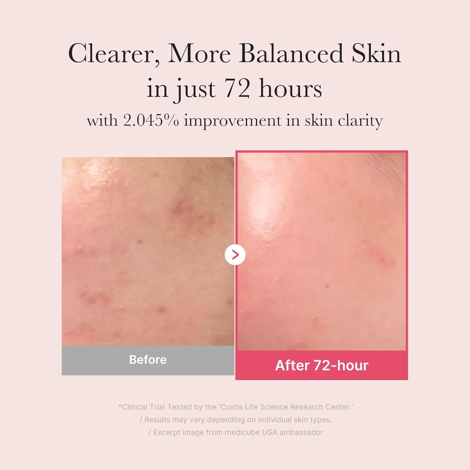 medicube TXA+Niacinamide 15% Glow Facial Serum for After Spot Care | All-in-One Daily Korean Skincare | Uneven Skin Tone, Texture, and Hydration Care | High-Potency Tranexamic Acid 5% | 1.01 fl.oz - Image 4
