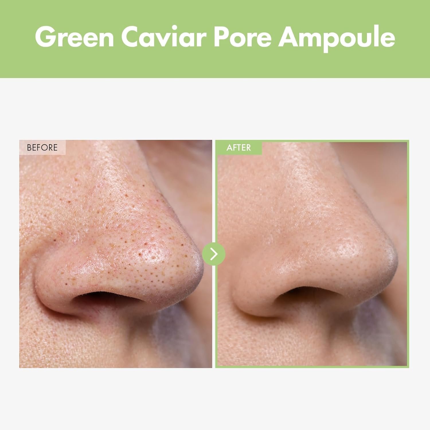 TOSOWOONG Green Caviar Pore Ampoule With 2,500ppm Green Caviar, Niacinamide, Pore Minimizer, Hydrating, Firming, Pore Tightening, Reduces Pores, Korean Skin Care, 33ml, 1.11 fl.oz. - Image 3
