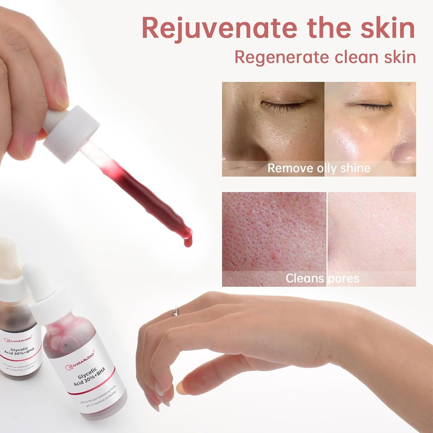 AHA 30% + BHA 2% Peeling Solution 30ml/1oz, Exfoliating Facial Serum, Chemical Peel For Face Serum Glycolic Acid - Image 5