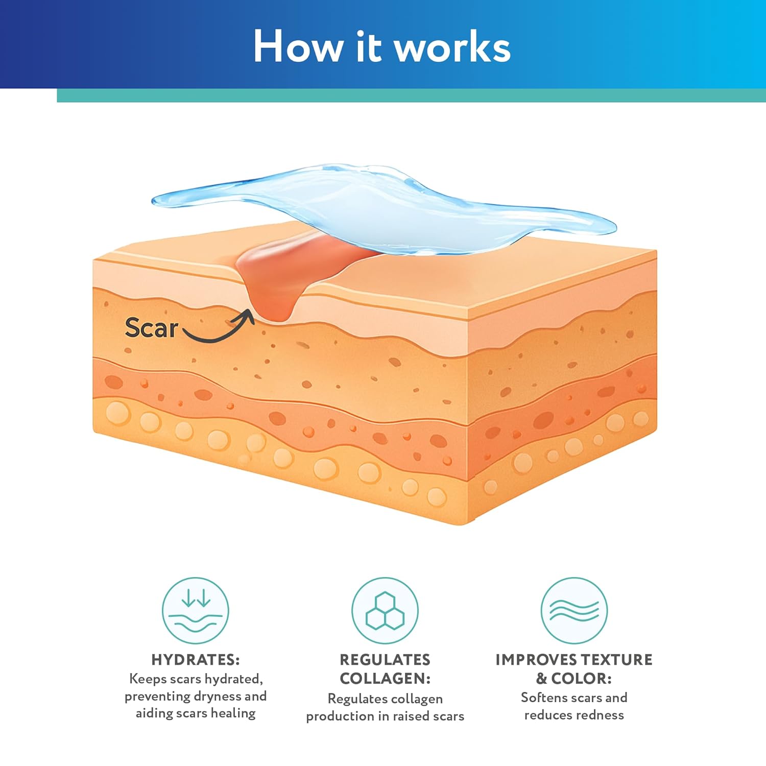 ScarAway Silicone Scar Gel, Helps Improve Size, Color & Texture of Hypertrophic & Keloid Scars from Injury, Burns & Surgery, Water Resistant, 10g (0.35 Oz) - Image 4