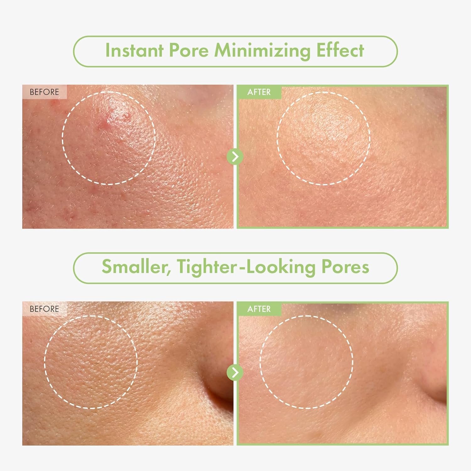 TOSOWOONG Green Caviar Pore Ampoule With 2,500ppm Green Caviar, Niacinamide, Pore Minimizer, Hydrating, Firming, Pore Tightening, Reduces Pores, Korean Skin Care, 33ml, 1.11 fl.oz. - Image 4