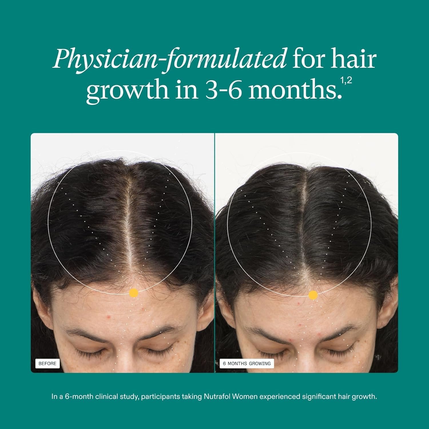 Nutrafol Women's Hair Growth Supplements, Ages 18-44, Clinically Proven for Visibly Thicker and Stronger Hair, Dermatologist Recommended - 1 Month Supply - Image 4
