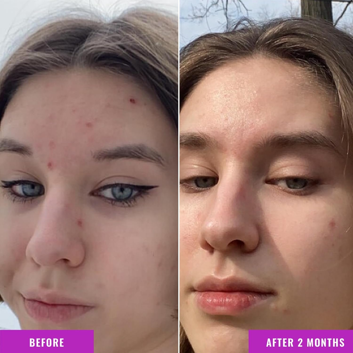 Good Molecules Niacinamide Serum - 10% Niacinamide to Target Acne, Nourishment, and Skin Tone - Ultra Hydrating Serum and Brightening Skin Care for Face - Image 5