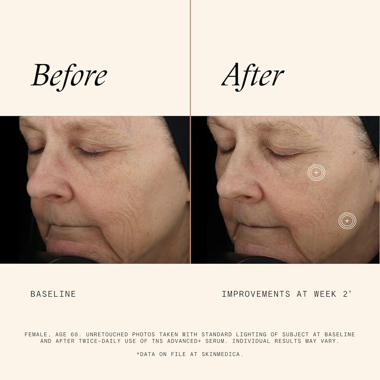 SkinMedica TNS Advanced+ Serum - Our Premium Facial Skin Care Product, the Secret to Flawless Skin. Age-Defying Face Serum for Women is Proven to Address Wrinkles and Fine Lines for Glowing Skin,1 Oz - Image 5