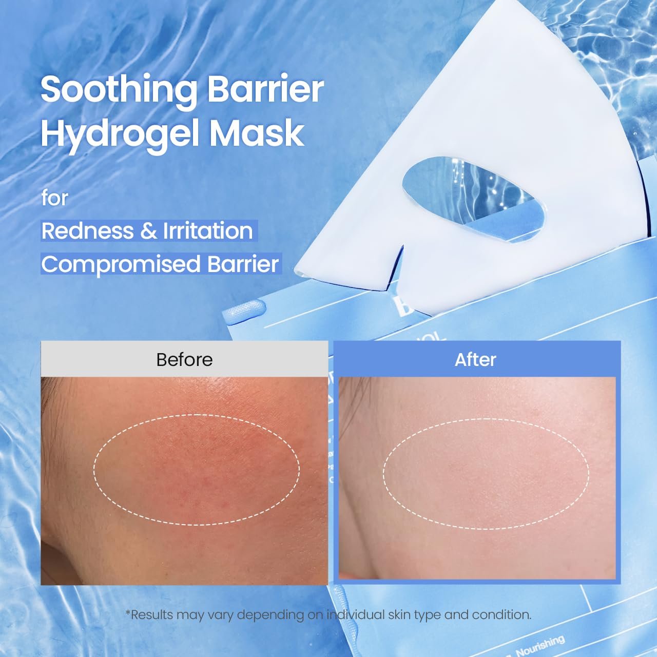BIODANCE Hydro Cera-nol Real Deep Mask, Overnight Hydrogel Mask, Hydrating Facial Mask For Sensitive Skin, Redness Reducing & Quick Soothing Effect, Korean Skincare, Stocking Stuffers |1.19oz(34g)x4ea - Image 2