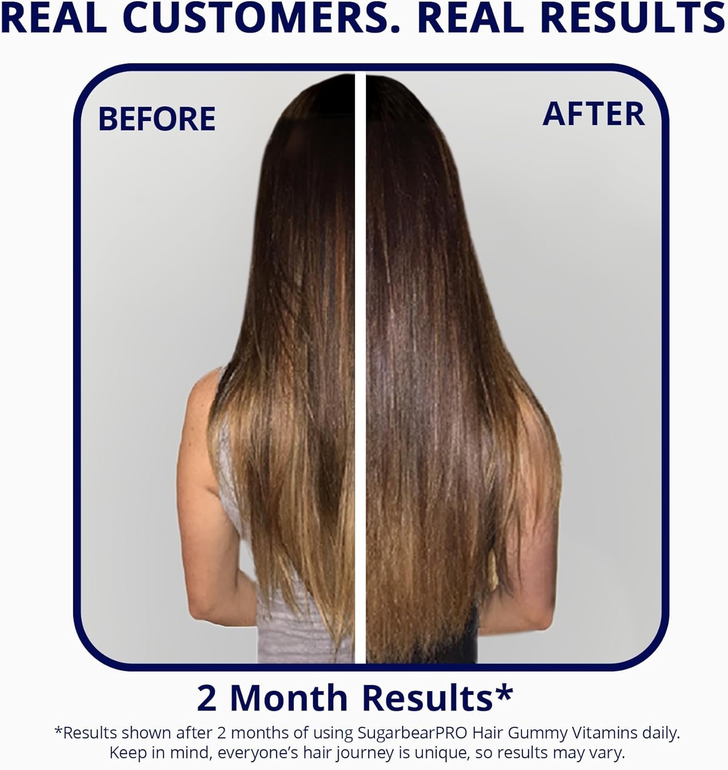 SugarBearPro Hair Vitamin Gummy 35 Day Supply, Extra Strength Biotin 6000mcg for Hair Growth, Vegan Vitamin B12, MSM, Inositol, Omega 3, Elderberry, Certified Kosher, Halal, Cruelty-Free - Image 3