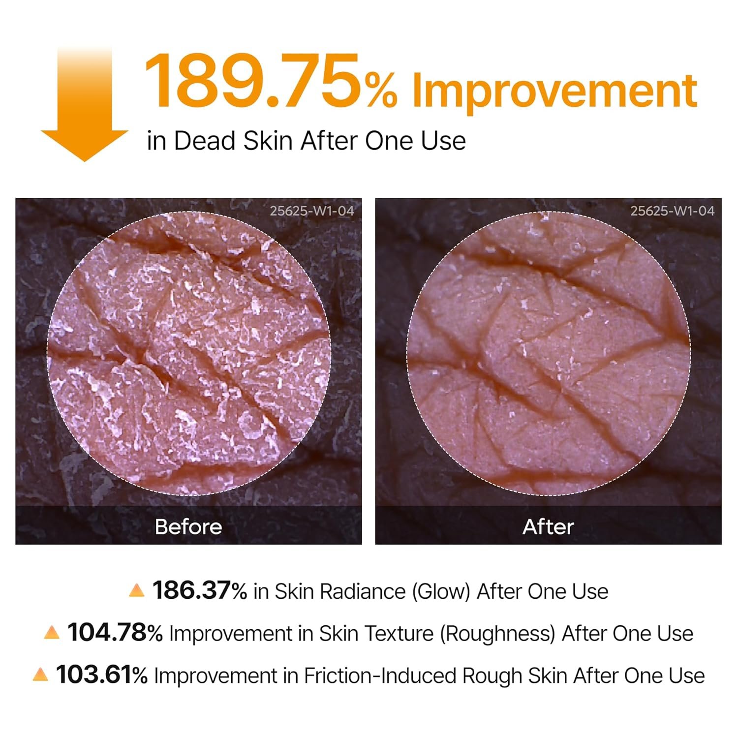 Dr.Melaxin Body Keratin Care Kojic Acid Turmeric Spray Gently Exfoliating Peeling Solution Korean Skincare All Skin Types 200ml - Image 5