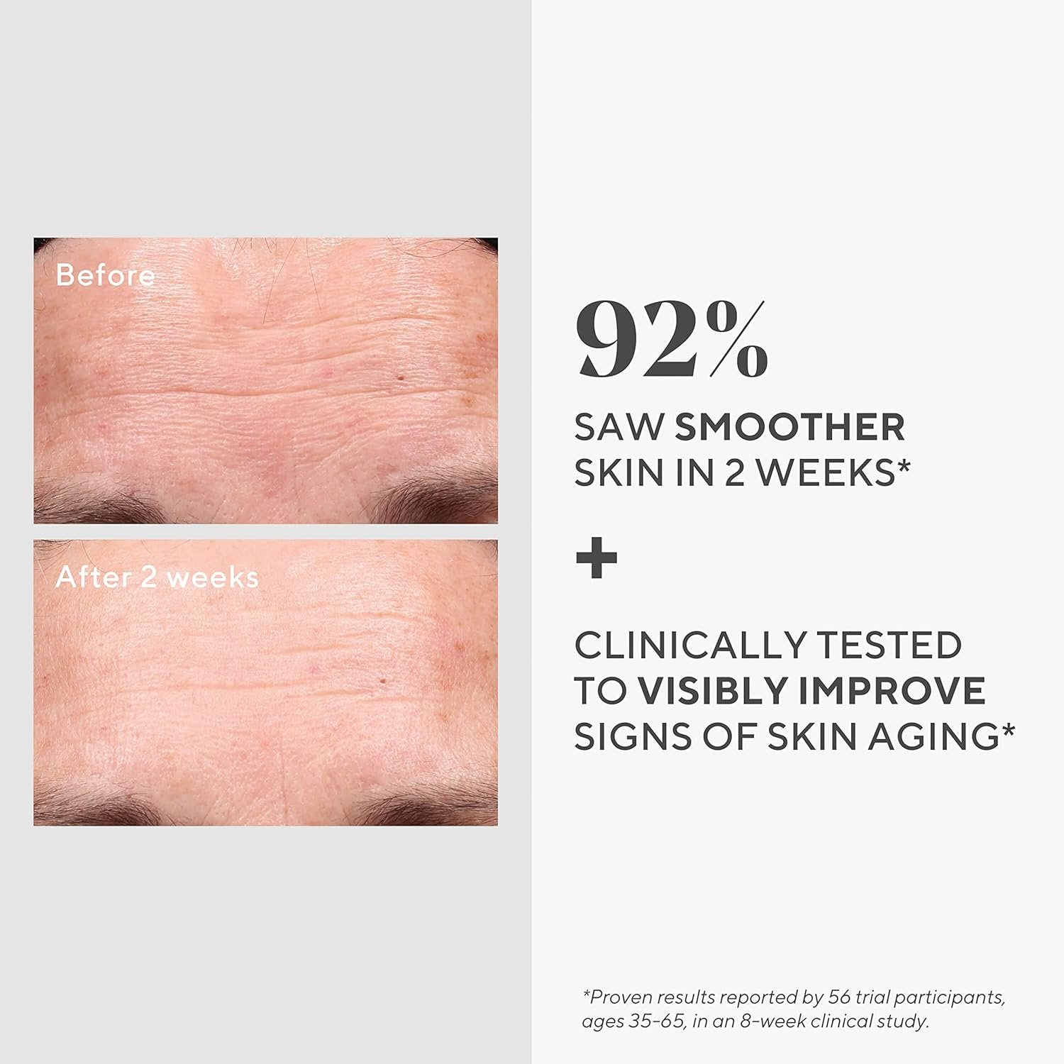 Murad Retinol Youth Renewal Serum - Fast-Acting Retinol Treatment with Swertia & Hyaluronic Acid for Visible Anti-Aging Results - Tri-active Technology Gently Reduces Wrinkles & Firms Skin - Image 3