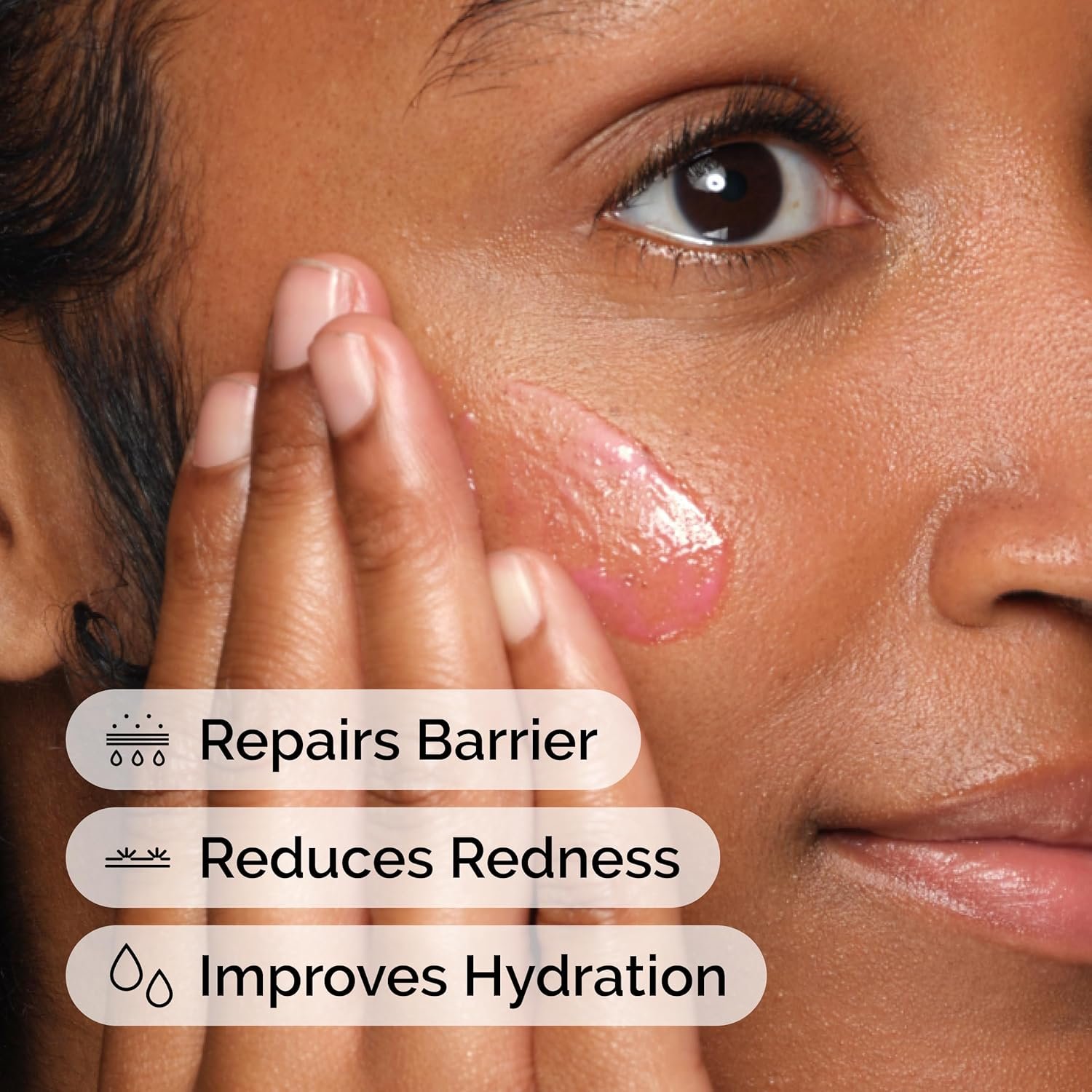 The Ordinary Soothing & Barrier Support Serum, Redness-Reducing & Hydrating Solution for Skin Barrier Recovery - Image 5