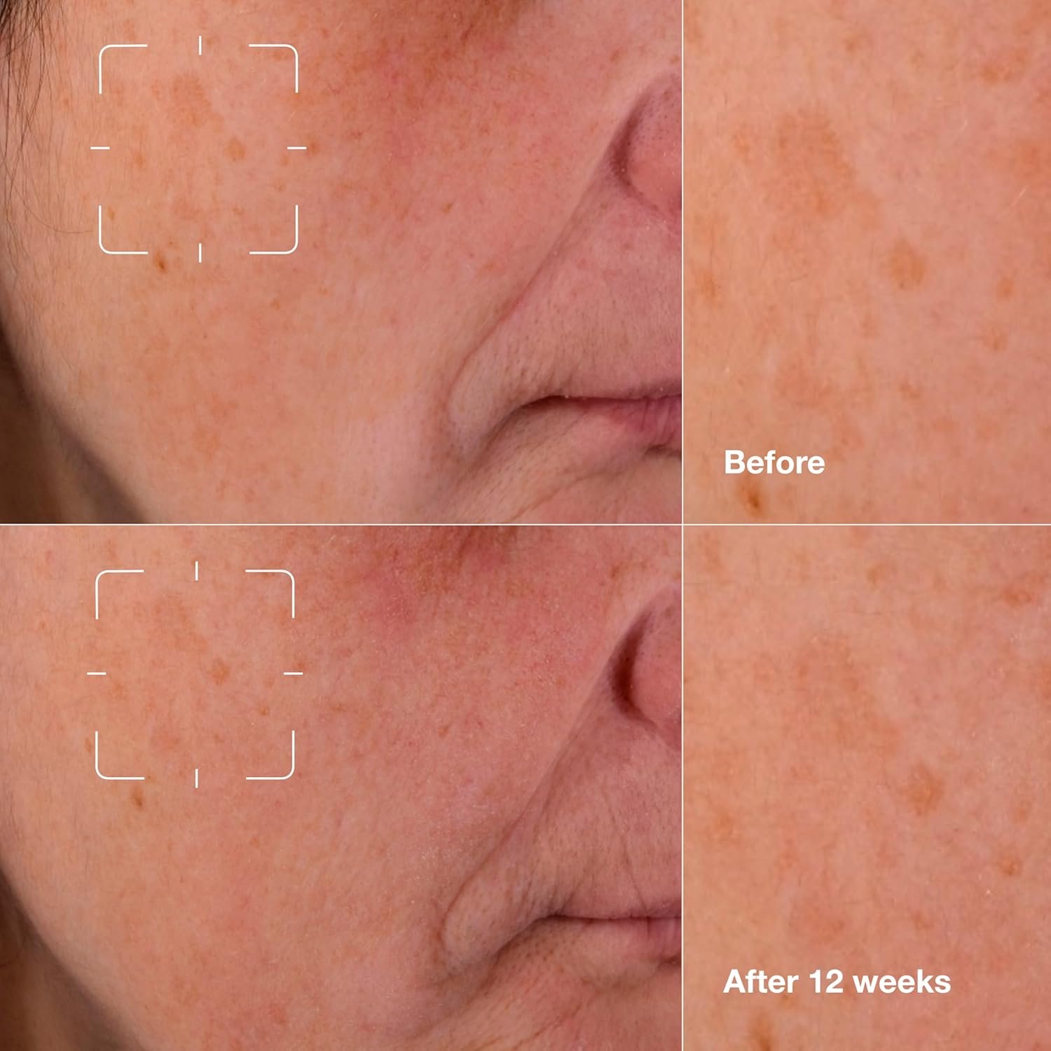 Clinique Even Better Clinical Dark Spot Clearing Vitamin C Face Serum For All Skin Types | Brightening + Soothing - Image 5