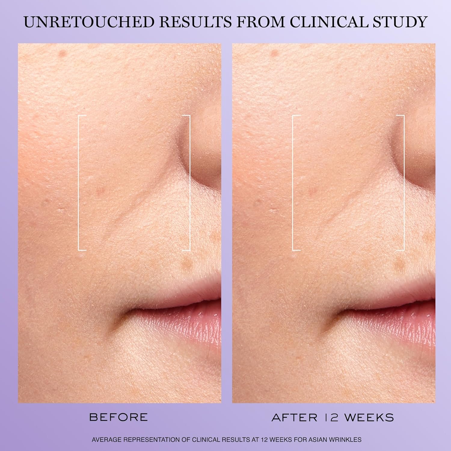 Lancôme Rénergie H.C.F. Triple Serum - Hyaluronic Acid Serum for Visible Correction of Anti Aging Signs & Dark Spots - With Vitamin C+, Niacinamide & Ferulic Acid - Image 5